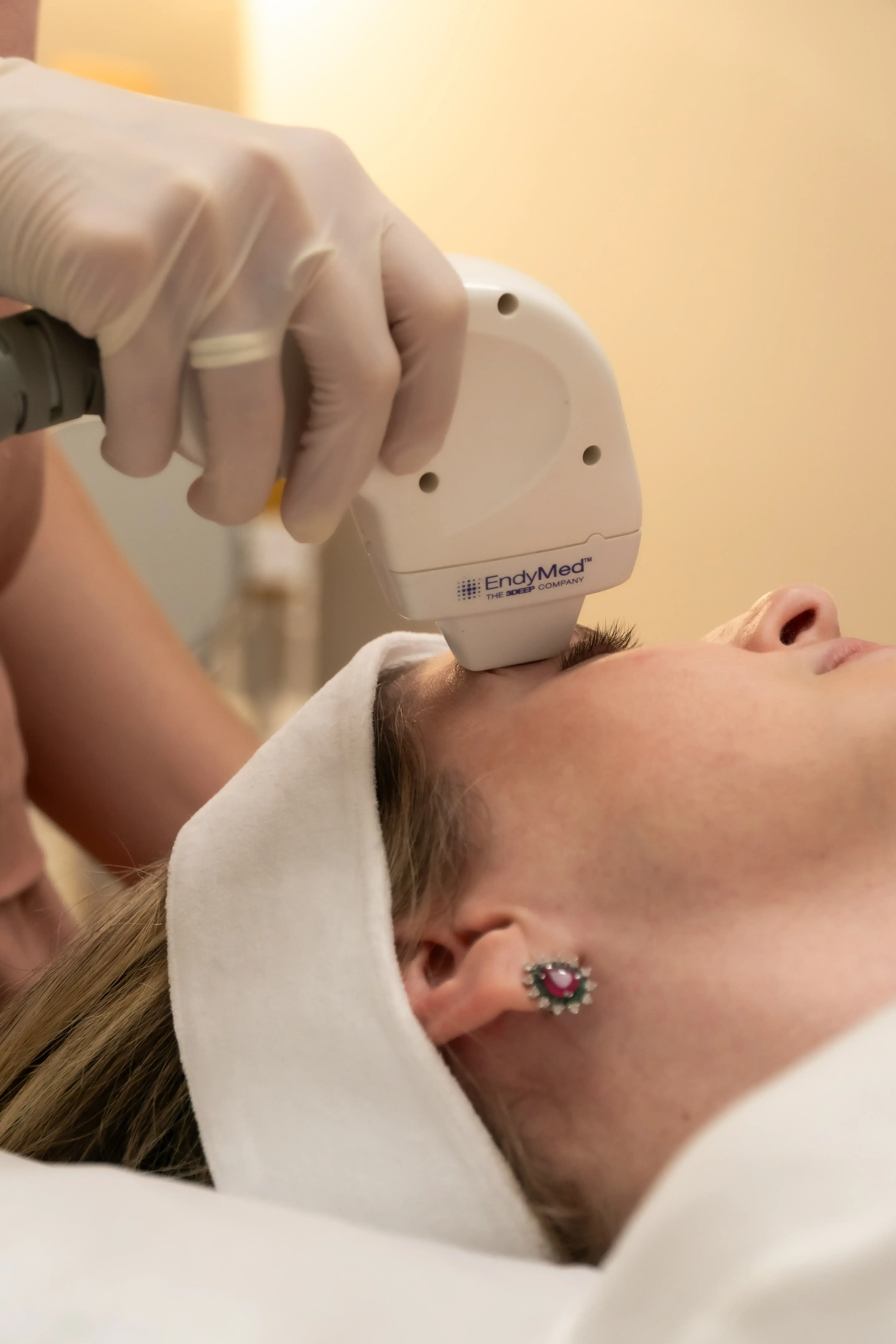 Tecnologia FSR - Tratamento para flacidez, textura irregular e regeneração da pele.